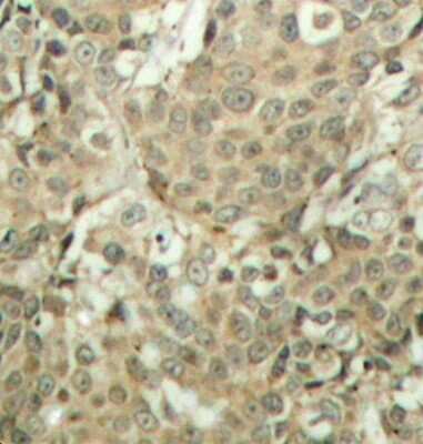 Immunohistochemistry-Paraffin: Cofilin [p Ser3] Antibody - Azide and BSA Free [NBP3-05394]